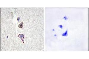 Immunohistochemistry (IHC) image for anti-Mannose Receptor, C Type 2 (MRC2) (AA 121-170) antibody (ABIN2889787)