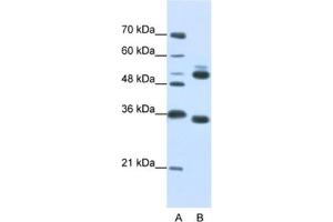 Western Blotting (WB) image for anti-WD Repeat Domain 6 (WDR6) antibody (ABIN2462385)