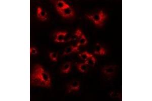 Immunofluorescent analysis of HAI-2 staining in Hela cells. (SPINT2 Antikörper)