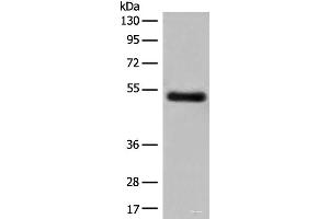 Western blot analysis of Human breast cancer tissue lysate using GK5 Polyclonal Antibody at dilution of 1:500 (GK5 Antikörper)