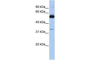 WB Suggested Anti-PHGDH Antibody Titration: 0. (PHGDH Antikörper  (Middle Region))
