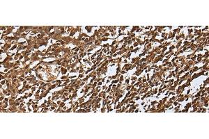 Immunohistochemistry of paraffin-embedded Human tonsil tissue using UBE2V1 Polyclonal Antibody at dilution of 1:30(x200)