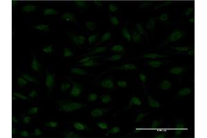 Immunofluorescence of monoclonal antibody to MYCBP on HeLa cell. (MYCBP Antikörper  (AA 34-103))