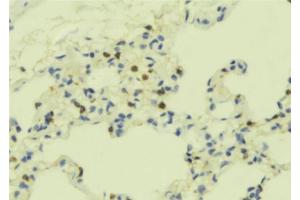 ABIN6273501 at 1/100 staining Mouse lung tissue by IHC-P.