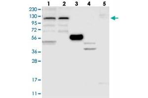 Western blot analysis of Lane 1: RT-4, Lane 2: U-251 MG, Lane 3: Human Plasma, Lane 4: Liver, Lane 5: Tonsil with ZSWIM5 polyclonal antibody . (ZSWIM5 Antikörper)