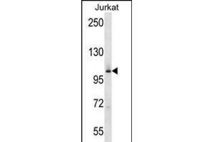 P4K2 Antibody (Center) (ABIN656275 and ABIN2845587) western blot analysis in Jurkat cell line lysates (35 μg/lane). (MAP4K2 Antikörper  (AA 321-349))
