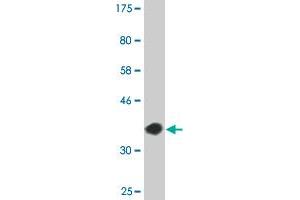 Western Blot detection against Immunogen (36. (CREB5 Antikörper  (AA 1-99))