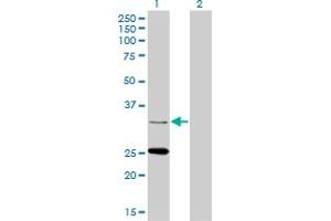 Western Blot analysis of STAR expression in transfected 293T cell line by STAR monoclonal antibody (M01A), clone 5F9. (STAR Antikörper  (AA 81-180))