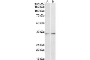 Image no. 1 for anti-CCAAT/enhancer Binding Protein (C/EBP), beta (CEBPB) (AA 68-81) antibody (ABIN5883747) (CEBPB Antikörper  (AA 68-81))