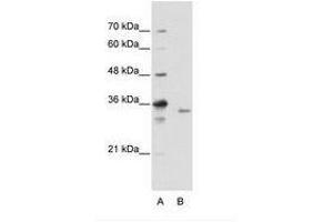 Image no. 2 for anti-Exosome Component 3 (EXOSC3) (C-Term) antibody (ABIN202145) (EXOSC3 Antikörper  (C-Term))