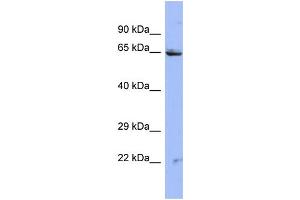 Host:  Rabbit  Target Name:  ZNF284  Sample Type:  HT1080 Whole cell lysates  Antibody Dilution:  1. (ZNF284 Antikörper  (N-Term))