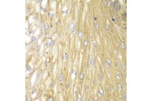 Immunohistochemistry (IHC) image for anti-Protein Phosphatase 2 Regulatory Subunit 2A (PPP2R2A) (AA 1-447) antibody (ABIN3023154)