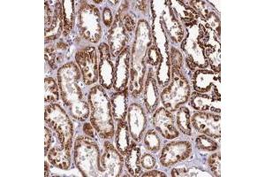 Immunohistochemical staining of human kidney with COQ9 polyclonal antibody  shows strong cytoplasmic positivity in renal tubules. (COQ9 Antikörper)