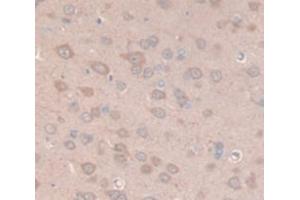 IHC-P analysis of Rat Tissue, with DAB staining. (Prolactin Antikörper  (AA 30-226))