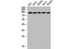 Western Blot analysis of 823 293T AD293 Hela HepG2 cells using NOXIN Polyclonal Antibody (C11orf82 Antikörper  (Internal Region))
