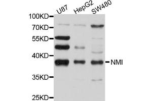 Western blot analysis of extracts of various cell lines, using NMI antibody (ABIN4904546) at 1:1000 dilution. (NMI Antikörper)