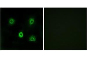 Immunofluorescence analysis of A549 cells, using ABHD6 Antibody. (ABHD6 Antikörper  (AA 231-280))