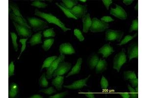 Image no. 4 for anti-ArsA Arsenite Transporter, ATP-Binding, Homolog 1 (ASNA1) (AA 239-349) antibody (ABIN598547) (ASNA1 Antikörper  (AA 239-349))