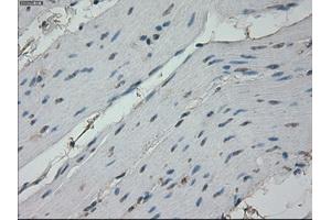 Immunohistochemical staining of paraffin-embedded colon tissue using anti-RPA2 mouse monoclonal antibody. (RPA2 Antikörper)