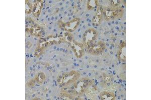 Immunohistochemistry of paraffin-embedded rat kidney using ARF1 antibody. (ARF1 Antikörper)