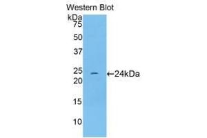 Western blot analysis of recombinant Rat TNNI1. (TNNI1 Antikörper  (AA 1-187))