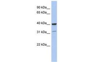 Image no. 1 for anti-Thrombopoietin (THPO) (C-Term) antibody (ABIN6744310)