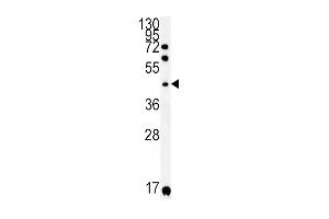 Western blot analysis in A2058 cell line lysates (35ug/lane). (KIR2DS2 Antikörper  (AA 39-65))
