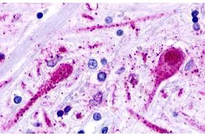 Image no. 1 for anti-Trace Amine Associated Receptor 2 (TAAR2) (Cytoplasmic Domain) antibody (ABIN1049380) (GPR58 Antikörper  (Cytoplasmic Domain))