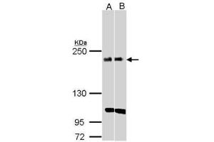 WB Image Sample(30 ug whole cell lysate) A:H1299 B:Raji , 5% SDS PAGE antibody diluted at 1:1000