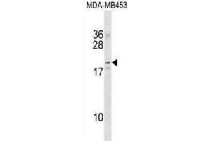 Western Blotting (WB) image for anti-Na+/K+ Transporting ATPase Interacting 2 (NKAIN2) antibody (ABIN2998903) (NKAIN2 Antikörper)