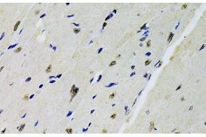 Immunohistochemistry of paraffin-embedded Mouse heart using DOK1 Polyclonal Antibody at dilution of 1:100 (40x lens). (DOK1 Antikörper)