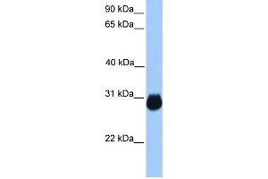 WB Suggested Anti-IGFBP7 Antibody Titration:  0.