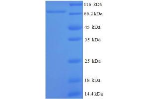 SDS-PAGE (SDS) image for ATP-Dependent RNA Helicase A (DHX9) (AA 325-840), (partial) protein (His-SUMO Tag) (ABIN5711235) (DHX9 Protein (AA 325-840, partial) (His-SUMO Tag))