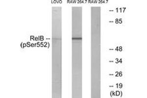 Western blot analysis of extracts from LOVO cells and RAW264. (RELB Antikörper  (pSer573))