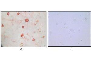 Immunocytochemistry analysis of TPA induced BCBL-1 cells (A) and uninduced BCBL-1 cells (B) using KSHV K8α mouse mAb with AEC staining. (KSHVK8a Antikörper)