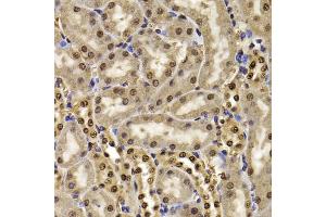 Immunohistochemistry of paraffin-embedded mouse kidney using HIRIP3 antibody (ABIN5974221) at dilution of 1/100 (40x lens). (HIRIP3 Antikörper)