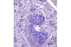 IHC analysis of RASAL1 using anti-RASAL1 antibody (ABIN6719367). (RASAL1 Antikörper  (AA 721-798))