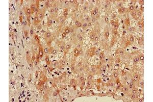Immunohistochemistry (IHC) image for anti-Aldehyde Dehydrogenase 3 Family, Member A1 (ALDH3A1) (AA 210-453) antibody (ABIN7143677)