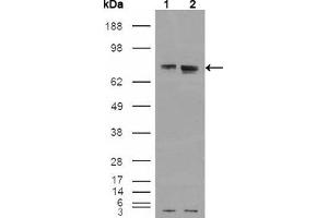 Western blot analysis using ER mouse mAb against HEK293T cells transfected with the pCMV6-ENTRY control (1) and pCMV6-ENTRY ER cDNA (2). (Estrogen Receptor alpha Antikörper)