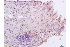 Formalin-fixed and paraffin embedded rat colitis labeled with Anti XRCC4 Polyclonal Antibody, Unconjugated (ABIN1386856) at 1:200 followed by conjugation to the secondary antibody and DAB staining (XRCC4 Antikörper  (AA 151-260))