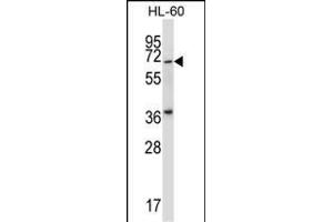 Mouse Pkmyt1 Antibody (N-term) (ABIN657999 and ABIN2846944) western blot analysis in HL-60 cell line lysates (35 μg/lane). (PKMYT1 Antikörper  (N-Term))