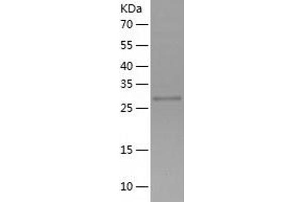 SNF8 Protein (AA 1-258) (His tag)