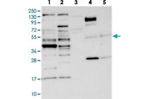 Western blot analysis of Lane 1: RT-4, Lane 2: U-251 MG, Lane 3: Human Plasma, Lane 4: Liver, Lane 5: Tonsil with CCDC34 polyclonal antibody  at 1:250-1:500 dilution. (CCDC34 Antikörper)