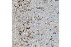 Immunohistochemistry of paraffin-embedded rat brain using MAPK11 antibody. (MAPK11 Antikörper)