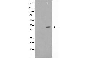Western blot analysis on Jurkat cell lysate using AL2S7 Antibody,The lane on the left is treated with the antigen-specific peptide. (Cyclin-Dependent Kinase 15 (ALS2CR7) (Internal Region) Antikörper)
