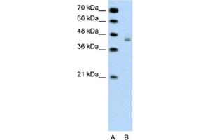 Western Blotting (WB) image for anti-DEAH (Asp-Glu-Ala-His) Box Polypeptide 30 (DHX30) antibody (ABIN2461364) (DHX30 Antikörper)