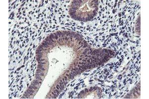 Immunohistochemical staining of paraffin-embedded Human endometrium tissue using anti-MIER2 mouse monoclonal antibody. (MIER2 Antikörper  (AA 1-296))