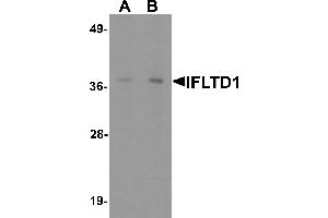 Western blot analysis of IFLTD1 in rat liver tissue lysate with IFLTD1 antibody at (A) 1 and (B) 2 µg/mL. (PAS1C1 Antikörper  (Middle Region))