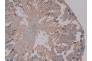 Detection of AMH in Rat Testis Tissue using Polyclonal Antibody to Anti-Mullerian Hormone (AMH) (AMH Antikörper  (AA 447-553))