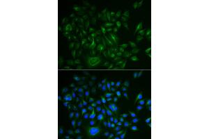 Immunofluorescence analysis of HeLa cells using BAMBI antibody (ABIN5973916). (BAMBI Antikörper)